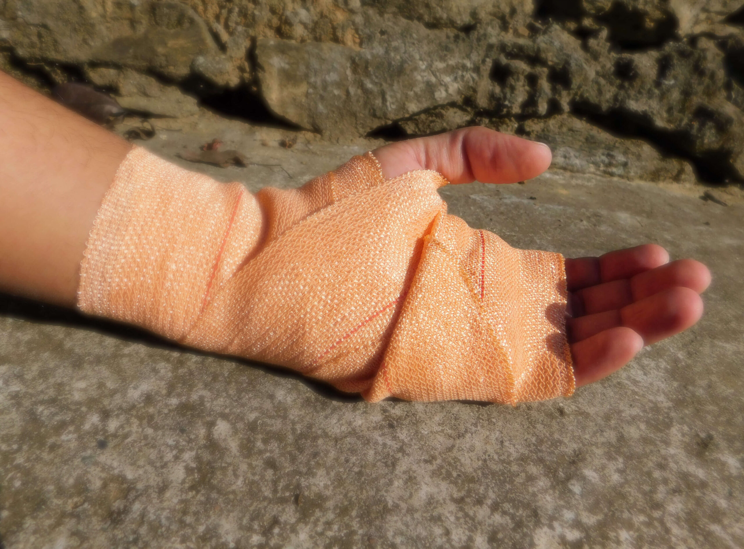 injury in mountaineering